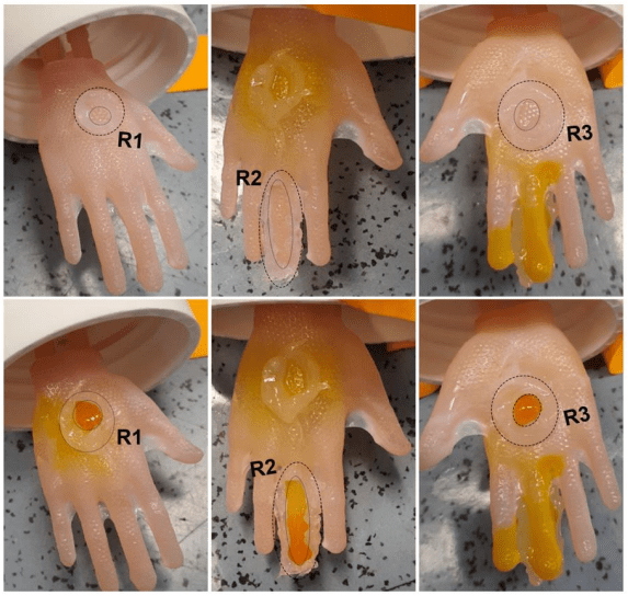 3D Artificial Skin Grafts Can Be Slipped On Like Clothing For Fiddly